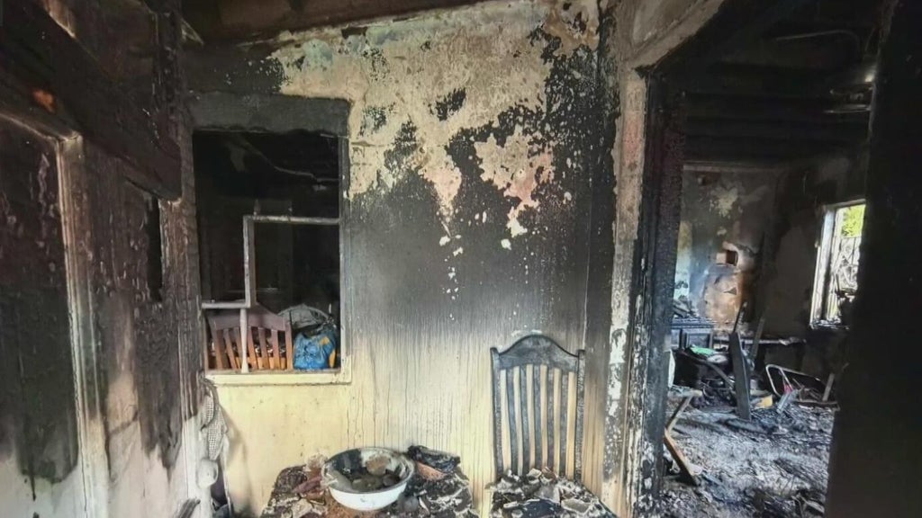 Woman hospitalized after Miami house fire leaves three displaced — CBS Miami, Denton Health news